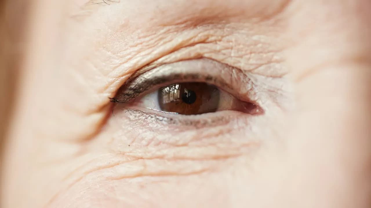 szemhéjplasztika utáni regeneráció